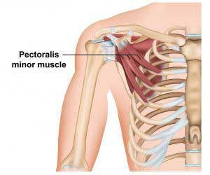 Shoulder pain fix
